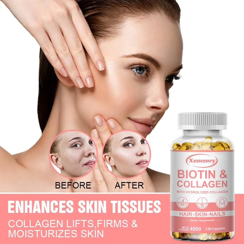 Biotin and Collagen Supplement, Vegan Capsules Non-Gmo, Gluten-Free